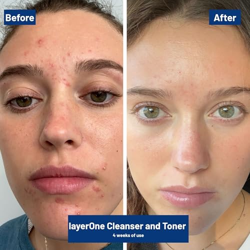 layerOne Clarifying Enzyme Toner ? Soothes, Hydrates & Refines Skin, Preps for Skincare Routine, 3.38 fl oz