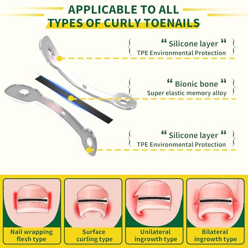 Small Size-Titanium Alloy Ingrown Toenail Treatment & Removal Kit for Quick Relief, Ingrown Toenail Removal Kit£¬ Professional Ingrown Toenail Corrector, Ingrown Toenail Tools for Quick Relief, 10 Pcs