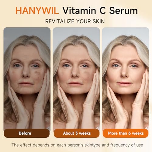 HANYWIL 20% Super Vitamin C Serum for Mature Skin, Targets Age Spot & Wrinkle Reduction with Hyaluronic Acid, Hydrating Anti-Age Serum 1.7fl oz