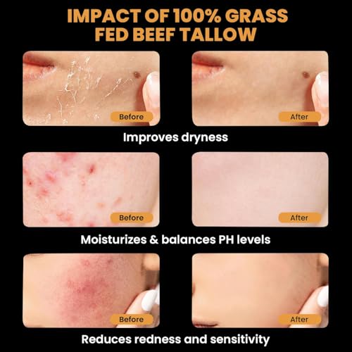 MONIER Tallow and Honey Balm for Face, Beef Tallow for Skin, Moisturizer with 100% Organic Grass-Fed Beef Tallow & Raw Wild Honey - Natural Formula for Dry & Sensitive Skin (Unscented)