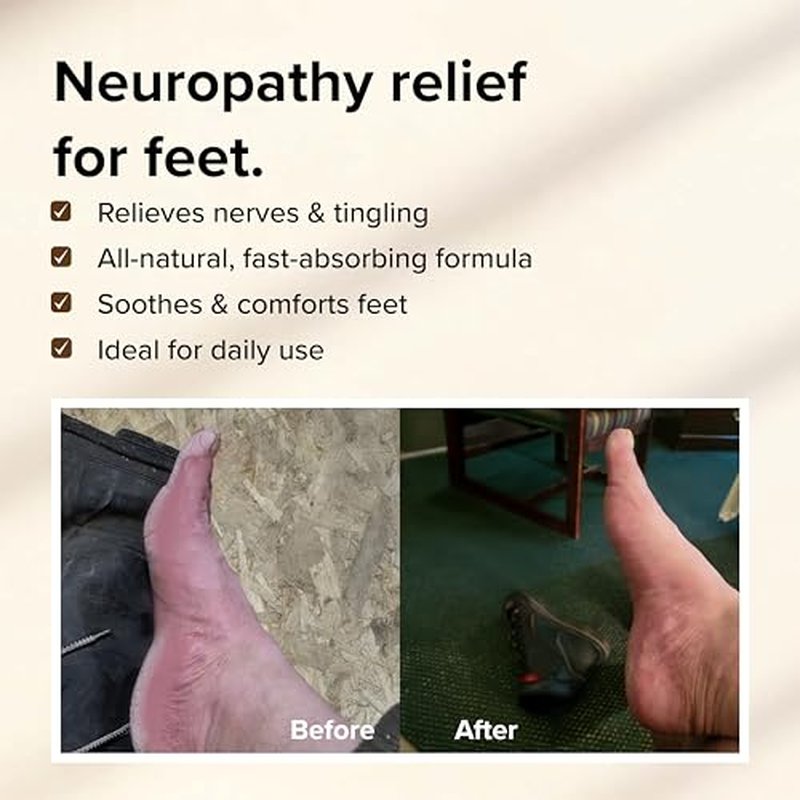 Nerve Comfort Cream for Feet ? ALL-NATURAL Shea Butter & Aloe Vera with Spikenard, Hyssop, Cassia & Cinnamon ? Soothes Tingling & Burning Nerves (1oz)