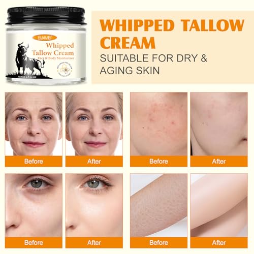 Grass-Fed Tallow & Raw Honey Balm | Whipped Skin Cream for Face & Body | Soothes & Repairs Dry, Sensitive Skin | Organic, All-Natural Deep Hydration (2.1 oz)