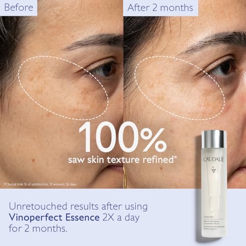Caudalie Vinoperfect Brightening Essence, Glycolic Acid Exfoliating Toner for Radiance