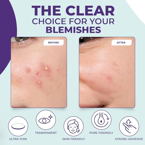 Pimple Patches for face and body | 36 Count (12mm), Invisible Hydrocolloid Acne patches ? Face Stickers for Zits, dark spot , Blemishes, Pore strips, Forehead pimple patch , Invisible spot cover