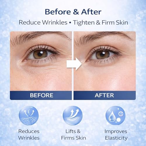 WEERSHUN Polypeptide Collagen Elastic Essence Cream, Micro-Molecular Collagen Moisturizing Lotion, Firming & Elasticity Support, Anti-Wrinkle Daily Skincare (4 Pcs)