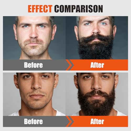 Para Barba Estimulante, Beard Care Cream Beard Growth Balm Ultra Potente B?lsamo de Crecimiento, New De Barba Hombre Moisturizes & Strengthens Facial Hair for Men 100ml / 3.5oz (1PCS)