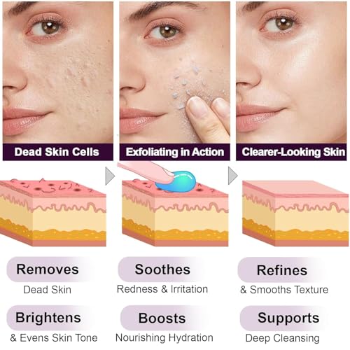 Black Rice Exfoliant, Peel Shot Glow Exfoliating Face Serum, Korean Skin Care Soft Exfoliating Body Scrub Dead Skin Cells, Blackheads Remover For All Skin Types 100ml