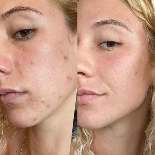 Gin Amber Beauty - Retinol 2.5% Serum - Anti-aging | Brighthening, Plant Based Retinol Serum (1 fl oz - 30 ml)