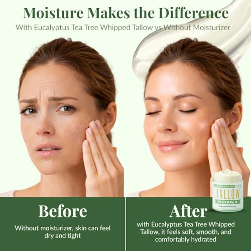 Whipped Tallow 24oz - All Natural Face Cream + Whole Body Moisturizer for Dry Skin - Made With Eucalyptus Oil - No Preservatives, Parabens or Seed Oils -USA Made (Eucalyptus Tea Tree)