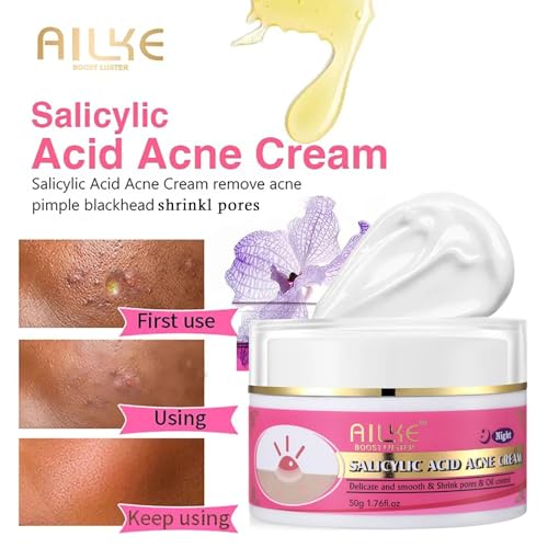 Salicylic Acid Acne Spot Removal Cream, Effectively Defeats Acne-Prone Skin, Refreshing, Oil Control, Prevent Breakouts, Pimples & Blackheads Remove Face Cream 1.76 oz