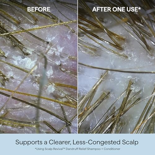 Briogeo Scalp Revival Dandruff Relief Conditioner | Charcoal + 1.8% Salicylic Acid | Daily Anti-Dandruff Conditioner for Flakes, Itch & Irritation | Color-Safe | Vegan & Cruelty Free | 8.4 oz