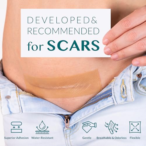 Silicone Scar Tape, Silicone Scar Sheets, Scar Tape for Surgical Scars, Silicone Tape for Scars, Scar Sheets for Surgical Scars, C-Section, Tummy Tuck and Keloid (1.6"x 60" Roll-1.5M)