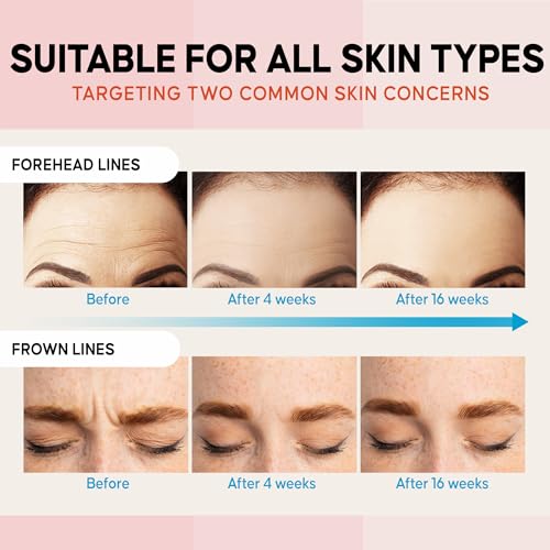 Forehead Wrinkle Patches Overnight : Forehead Fine Lines and Deep Wrinkles Treatment Remover, Anti Forehead and Between the Eyes Facial Wrinkle Patches, Hypoallergenic Patches with Collagen12 Pcs