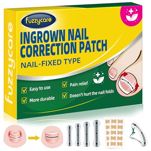 Small Size-Titanium Alloy Ingrown Toenail Treatment & Removal Kit for Quick Relief, Ingrown Toenail Removal Kit£¬ Professional Ingrown Toenail Corrector, Ingrown Toenail Tools for Quick Relief, 10 Pcs