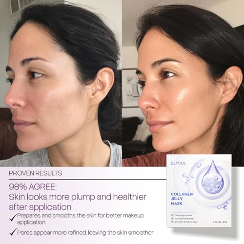 Collagen Jelly Mask ? With 83% Hydrolyzed Collagen & Niacinamide | Hydration, Refreshing Essence, Suitable for All Skin Types ? 5 Sheets