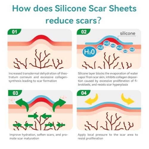 Dimora 2 Packs 6oz Hydrogel First Aid Ointment & Waterproof Silicone Scar Sheets