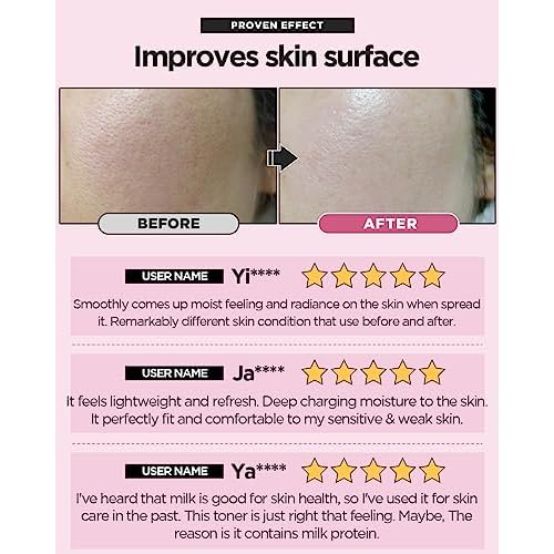 SKINRxLAB MadeCera Cream Double Essence Korean Toner 150ml (5.07fl.oz.) - Hydrating and Soothing with Milk Protein, Ceramide, Beta-Glucan - Moisturizing Strawberry Milky Toner for Irritated Skin