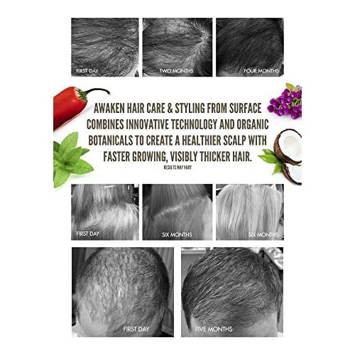 Surface Hair - Awaken Therapeutic Scalp Elixir ? Natural Ingredients for Thinning Hair and a Healthy Scalp - 4 fl oz