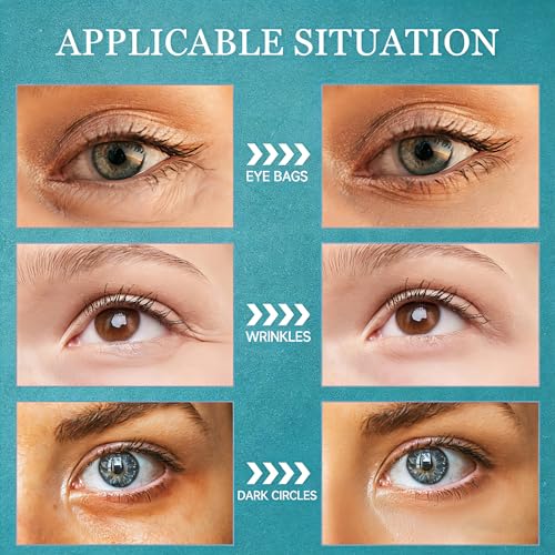 Under Eye Cream for Eye Bags and Wrinkles, 15g Eye Cream Visibly Improves for Dark Circles and Puffiness Tightener Dark Circles for Men & Women Moisturizing Under Eye Cream