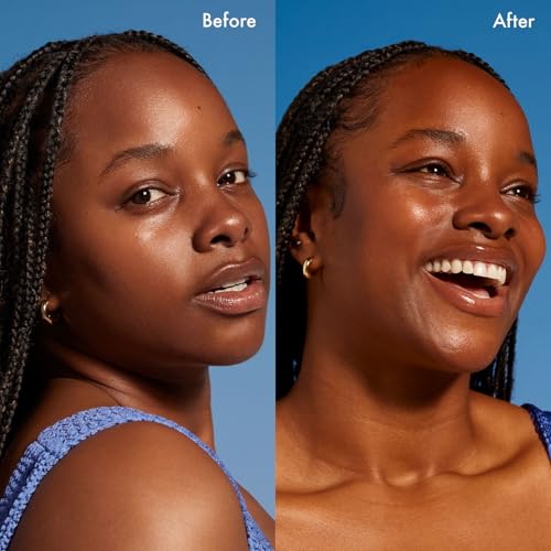 Remedy for Dark Spots | Advanced Night Treatment with Retinol & Kojic Acid | For Discoloration and Uneven Tones | With Glutathione, Niacinamide, Mandelic Acid | By Dermatologist Dr. Shah, 1 fl. oz