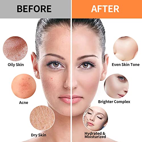 24K Gold & Hyaluronic Acid Jelly Mask, Facial Skin Care- Collagen Peel-Off Jelly Mask Set, For Facials, Face Mask For Instant Hydration, Vegan Peel Off Face Mask, For Hydration
