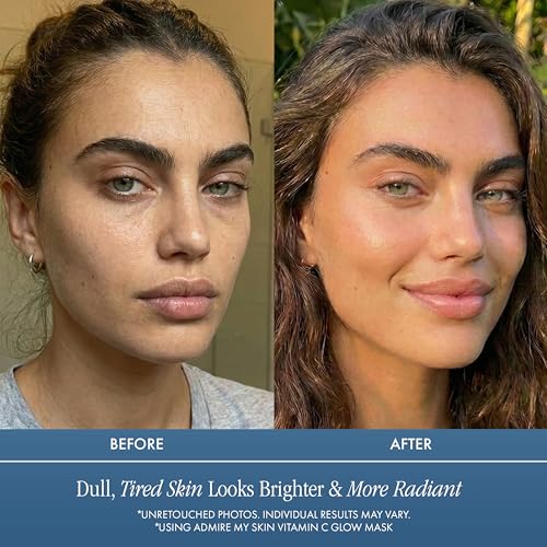 Vitamin C Mask for Face ? Brightening Face Masks Skin Care Contains Glycolic Acid and Lactic Acid + Squalane Oil ? Hydrating Beauty Face Mask for Glowing Youthful Skin and Smooth Even Skin Tone 2oz