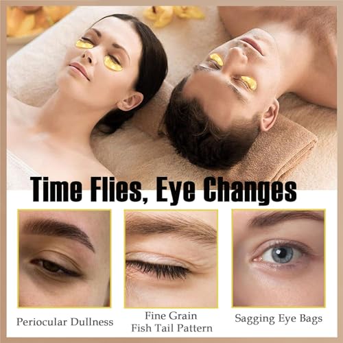 Miniling 30 Pairs Eye Masks & Lip Masks, Under Eye Patches for Dark Circles, Lip Mask Skincare, Easter Basket Stuffers, Bulk Gifts, Mothers Day Gifts for Mom, Teacher Appreciation Gifts, Small Gifts