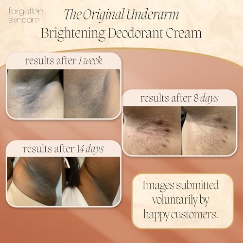 Forgotten Skincare The Original Underarm Brightening Deodorant Cream For Dark Underarms Treatment, Body Odor Eliminator For Women & Men, Ingrown Hair Treatment, Vitamin C & Salicylic Acid