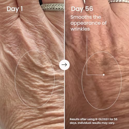 MA?LYS B-GLOSSY Smoothing Body Serum for Women - Hyaluronic Acid & Peptide Formula - Helps Reduce the Look of Wrinkles, Texture & Crepey Skin - Lightweight, Fast-Absorbing Anti-Aging Serum (3.4 Fl Oz)