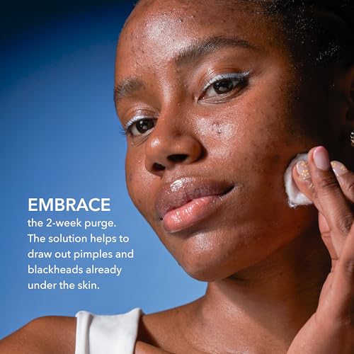 Dr Dennis Gross Alpha Beta¢ç 2% BHA+ Breakout Solution, Minimizes Pores, Clear & Prevent Breakouts, 5 Fl Oz