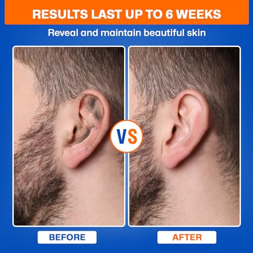 2-in-1 Ear & Nose Waxing Kit for Men & Women | 100g Hair Removal Wax + 99pc | 20 Applicators, 10 Nasal Sticks, 15 Wipes & 20 Earplugs | No Microwave Needed | Nose Wax Kit, Ear Hair Remover