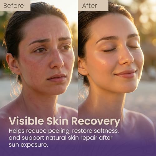 After Sun Lotion with Honey & Lavender ? Hydrating & Soothing Moisturizer for Sunburned Skin ? Natural Aloe Vera, Vitamin E & Jojoba Oil ? Paraben-Free ? 8.45 fl. oz (250ml)