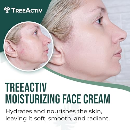 TreeActiv Acne Eliminating Face Cream | Tea Tree Moisturizing Formula for Balanced, Fresh-Looking Skin | Suitable for Sensitive Skin | For Adults and Teens | 2 fl oz