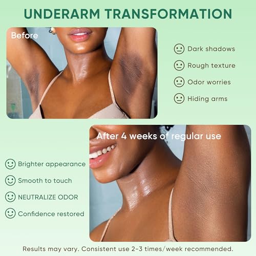 Armpit Detox Scrub & Underarm Exfoliator - Walnut Shell, Menthol & Aloe Vera Body Scrub for Odor, Deodorant Buildup, and Dark Spots - Moisturizing Formula for Sensitive Skin, Vegan 8.8 oz