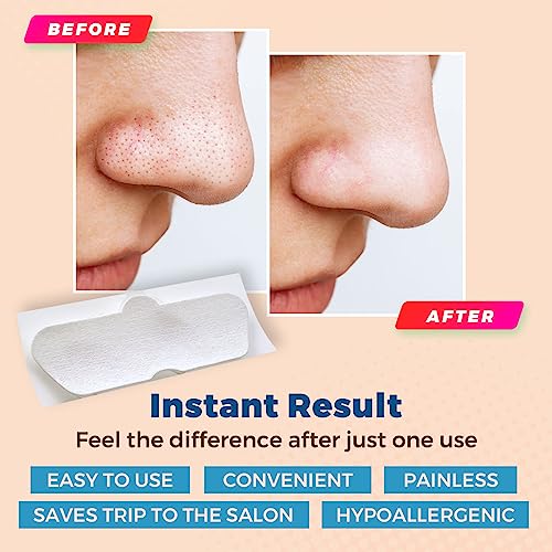 MEDca Deep Cleansing Blackhead Pore Strips - Pack of 48 Peel - Off Blackhead Remover and Pore Unclogging Strips for Nose and Face, Chin, Forehead & Healthier Looking Skin