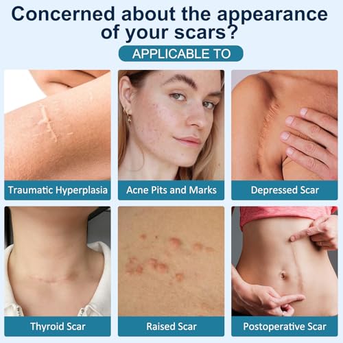 Scar Stick for Scars After Surgery & C-Section, Cocoa Butter Stick with Vitamin E for Scars, 5-in-1 Smoothing Formula to Improves Texture & Discoloration, Non-Greasy (0.7 oz)
