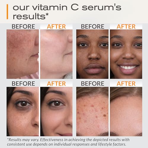 Ella & Eden Vitamin C Serum for Face - Hyaluronic Acid, Aloe Vera, Vitamin E, CoQ10 - Anti-aging, Skin Brightening - Paraben-Free, Fragrance-Free, Suitable for All Skin Types - 1 Fl Oz