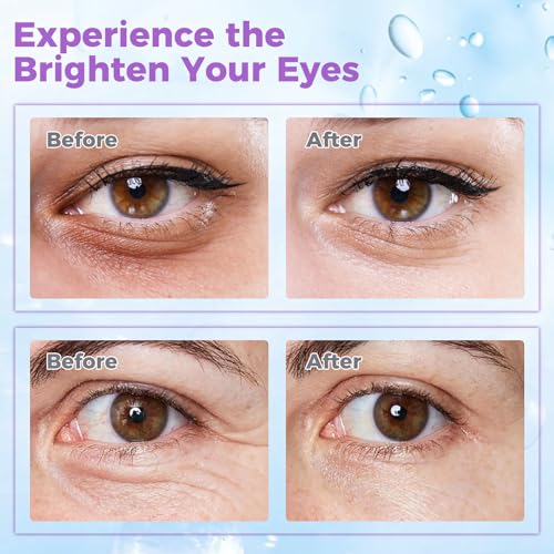 Eye Cream for Dark Circles & Puffiness ? Revitalizing Formula with Retinol, Hyaluronic Acid, Caffeine, Peptides & Plant Extracts to Smooth Fine Lines