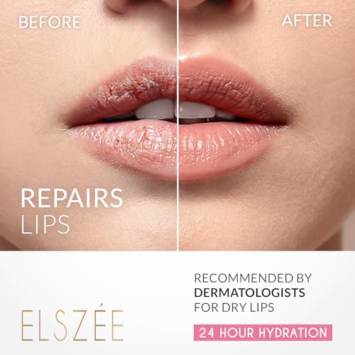 ELSZ?E Loveable Lips | Lip Mask with Hyaluronic Acid | Smooth, Volumize and Hydrate Dry Lips | Day & Night Treatment