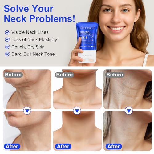 Neck Firming Cream with Roller, AH-8 Firming Neck Cream for Sagging and Tighten, Best for Tightening Sagging Skin, Lifting firming Cream for Loose Skin, Reduce Wrinkles, Fine Lines,Nourish, 8.46 Fl Oz