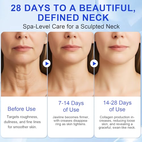 AH-8 Firming Neck Cream,Firming Lifting Neck Creams for Tightening & Moisturizing Skin with Massage Roller, AH-8 Neck Cream for Crepey Skin,Hydrating & Reduce Wrinkles for Men and Women