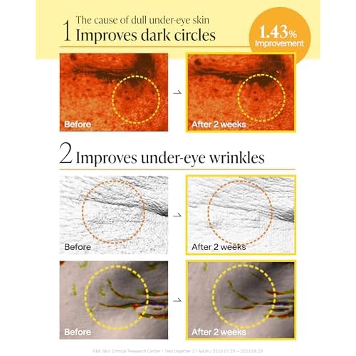 Korean Under Eye Patches for Dark Circles & Puffiness ? Vita 500Da Fabric-Free Collagen Gel, 83% French Collagen + Niacinamide & Peptides, Cooling Depuffing, Turns Clear, 60 Patches