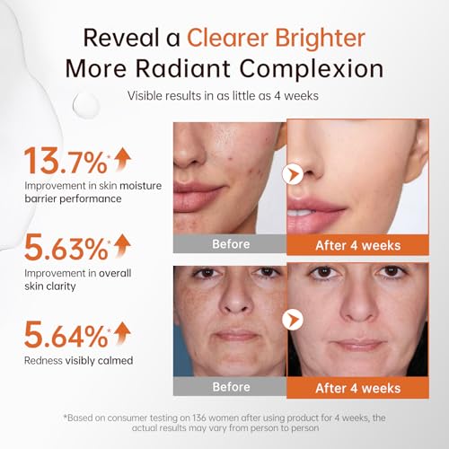 BOLI Kojic Acid Serum, Ultra Brightening Glow Serum Peptide Retinol Niacinamide for Dark Spots (1.01 fl oz)
