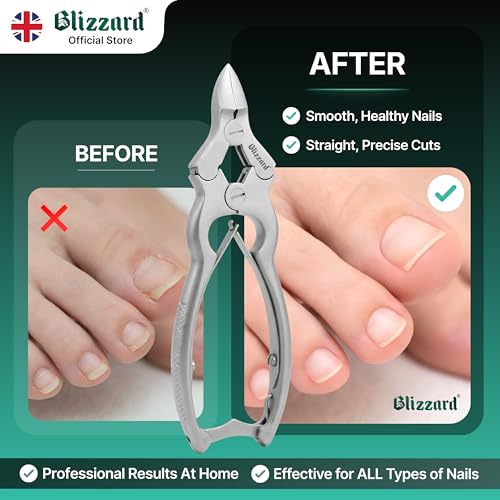 Toenail Clippers by Blizzard ? Medical Grade Double Action Toe Nail Nipper Cutter for Thick Nails Seniors ? 6 inch German Tool Double Spring