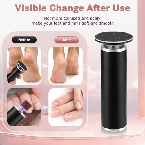 Electric Callus Remover for Feet, FSA Eligible Items List, Foot File Grinder Tool with Replacement Sandpaper Disk and Nail Drill Bits, HSA Approved Products Only