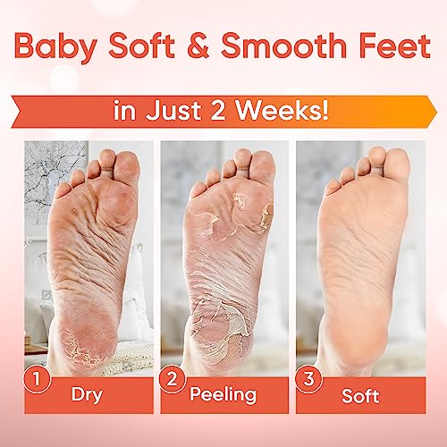 C?LOR Foot Peeling Mask for Dry Cracked Feet | Foot Mask to Exfoliate Rough, Cracked, Dry Feet, Calluses for Soft Baby Feet Results | Made with Aloe Vera Extract for Women & Men (5 Pairs) | Peach