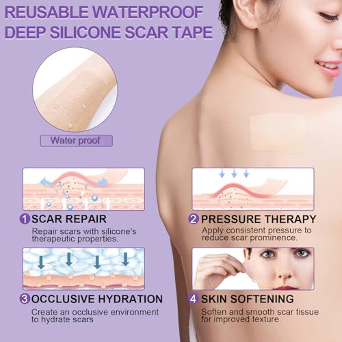 Silicone Scar Sheets, Medical Grade Silicone Scar Tape (1.6" x 60"), Professional Scar Removal Treatment, Reusable, for Healing Keloids, Surgeries Scars, C-sections, and Burns