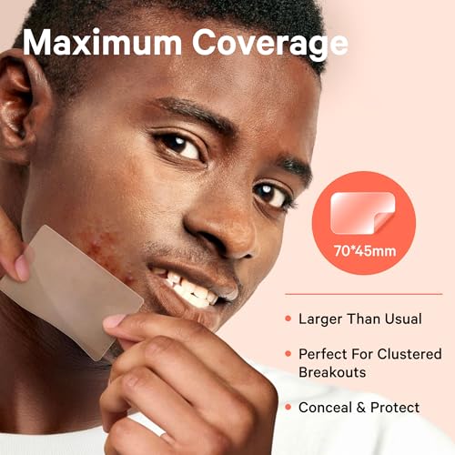 Sosky Large Pimple Patches XL Hydrocolloid Acne Patches for Face & Body Cystic Pimple & Zit Patch for Nose Chin Back, Bacne & Breakouts Vegan Cruelty-Free£¨10 Count£©