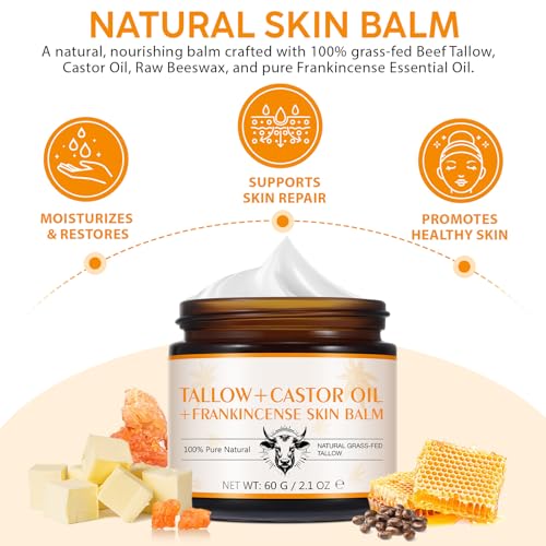 Grass-Fed Beef Tallow Cream with Frankincense and Castor Oil 2.1 fl.oz, Raw Honey for Skin Care,Face & Body Moisturizer for Skin,Sensitive Skin & Dry Skin Age Defying, Eczema All-Purpose Balm