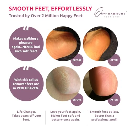 Electric Callus Remover for Feet: Professional Foot Care for Women by Own Harmony - Rechargeable Pedicure Tools - Electronic Foot File Pedi Sander - Best for Hard, Dry, Dead, Cracked Skin (3 Rollers)